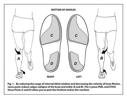Inside Arch Support