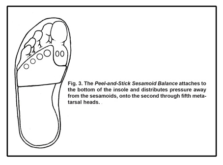 Sesamoiditis Pad
