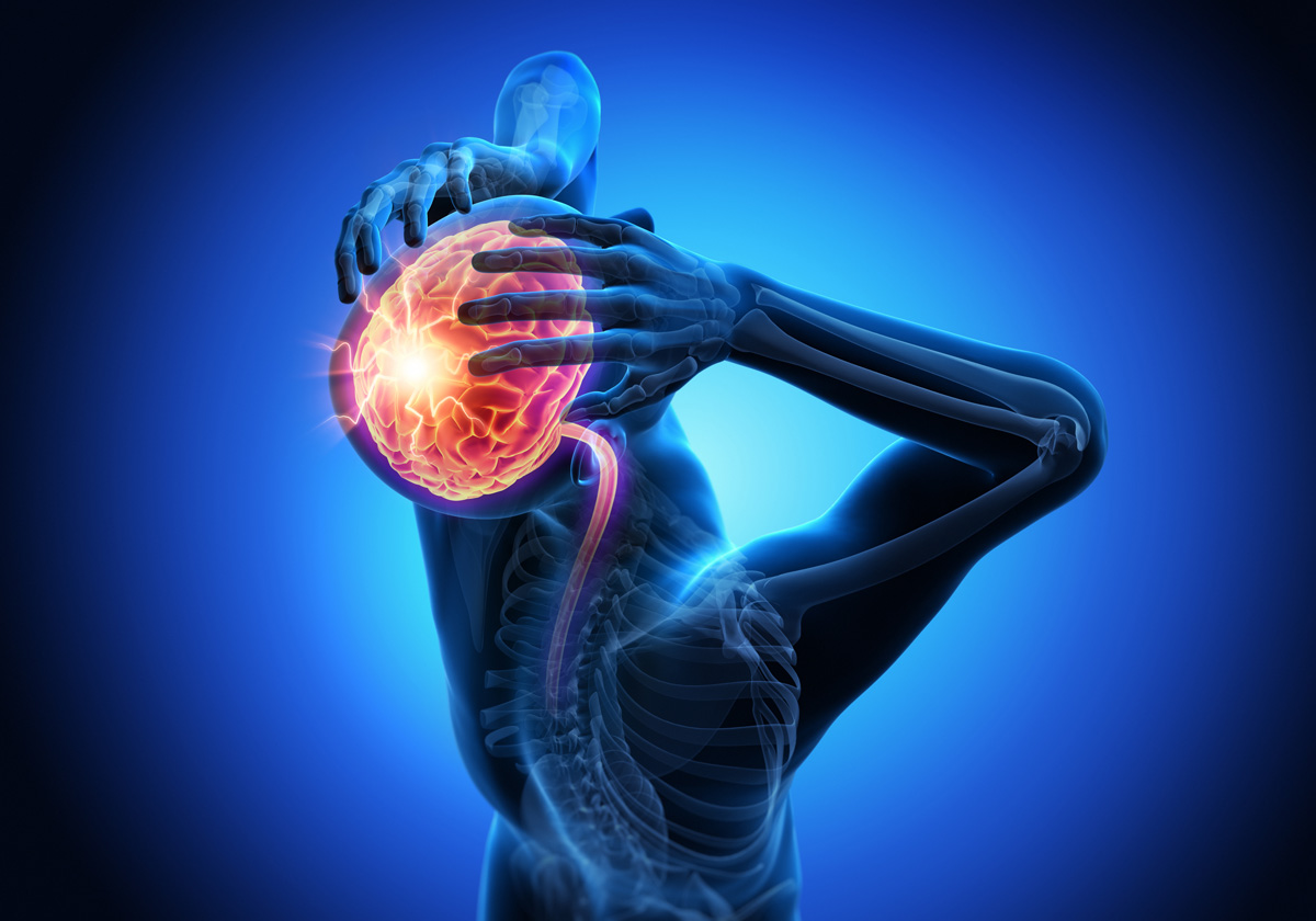 3D illustration of a person experiencing severe migraine pain