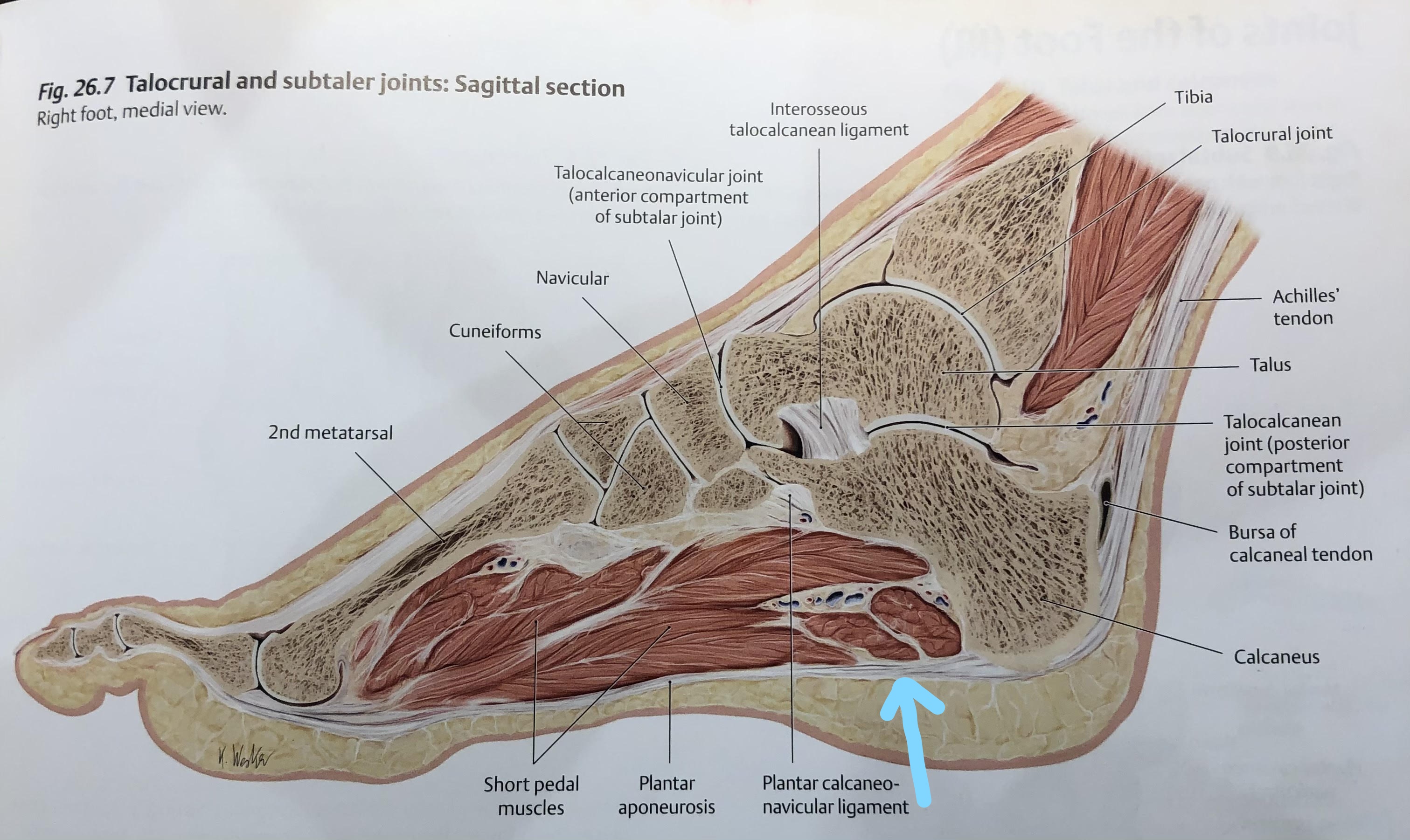 Is it Plantar Fasciitis?