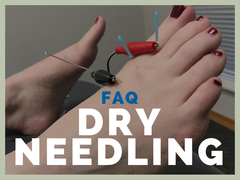 WB---FAQ-Dry-Needling