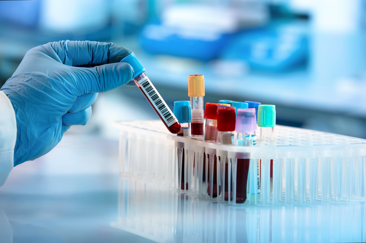 testing blood for lactic acid