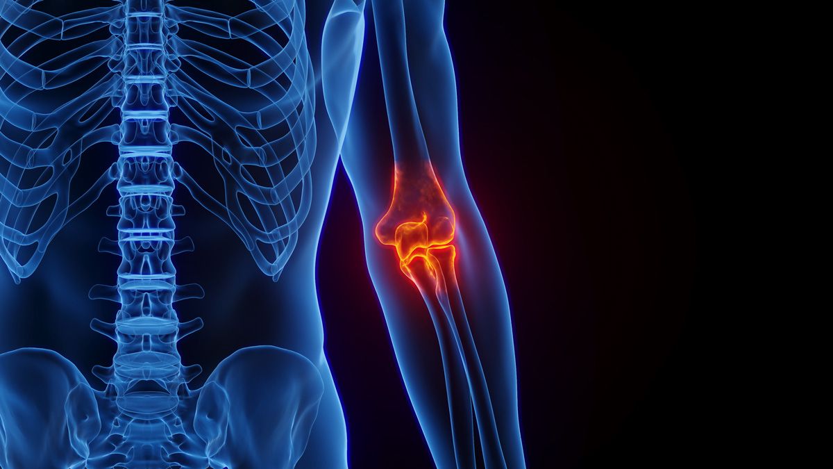3d rendering of person highlighting severe elbow pain